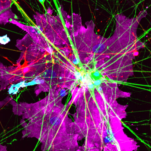 Human stem cells were used to generate four major brain cell types—excitatory and inhibitory neurons (green and red), astrocytes (magenta), and microglia (cyan). Together, they form a 2D human model of how the brain’s diverse cell types interact and communicate.