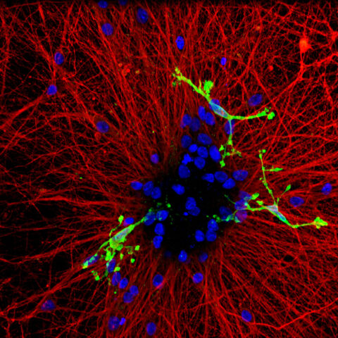 Microglia (green) remodel synaptic connections, while inhibitory neurons (red) maintain network balance. This human stem cell–derived co-culture is used to investigate how microglia refine inhibitory synapses to tune neural communication.
