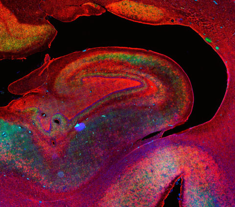 Human hippocampus, the brain region where memories are consolidated. Astrocytes were stained with the cytosolic marker ALDH1L1 (green) and the endfeet marker AQP4 (red). All nuclei were stained with DAPI (blue).