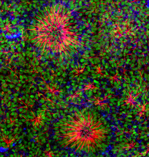 Cortical neurons derived from human induced pluripotent stem cells (reprogrammed from skin tissue), grown for 14 days in a dish. The rose-like structures are called neuronal rosettes. The blue staining marks all cell nuclei, the red staining marks microtubules, and the green staining reveals expression of one transcription factor specific to cortical neural progenitor cells (FOXG1).