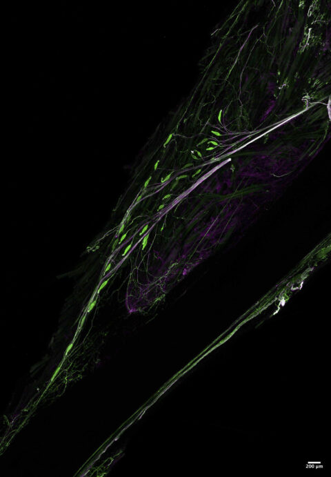 his image shows Pacinian corpuscles in the mouse hindlimb, located along the fibula, which each have an inner corpuscle composed of terminal Schwann cells (green), innervated by a single peripheral axon (magenta).