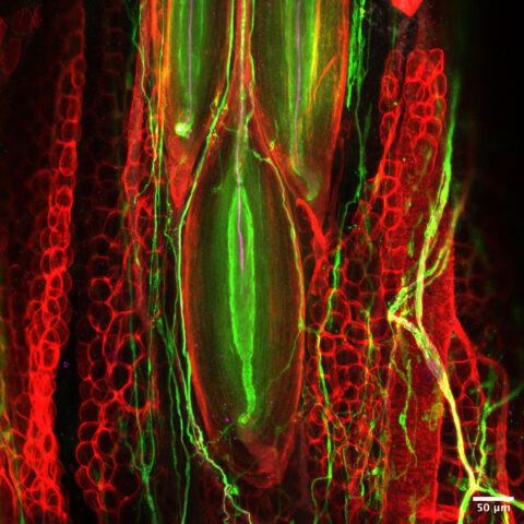 This image shows Pacinian corpuscles in the mouse hindlimb, each innervated by an axon (magenta), with supportive cells forming an inner (green) and outer corpuscle (red). The outer corpuscles touch, likely to assist signal transduction to the central nervous system.