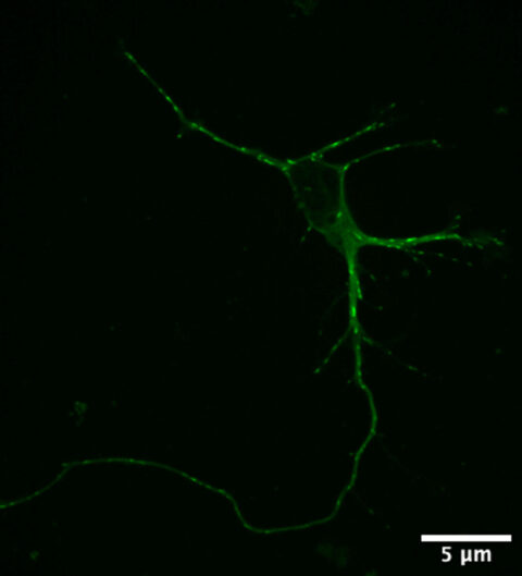 The image depicts EB3–GFP–labeled microtubule plus-end tracking proteins in a cultured mouse hippocampal neuron.