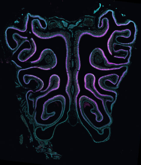 This image depicts a cross-section of the mouse nose after treatment with a drug that ablates the olfactory tissue, stained for a sensory neuron marker gene (in magenta) and specific subtypes of olfactory receptors (in yellow ). The expression of these genes and their spatial patterns indicates proper regeneration.