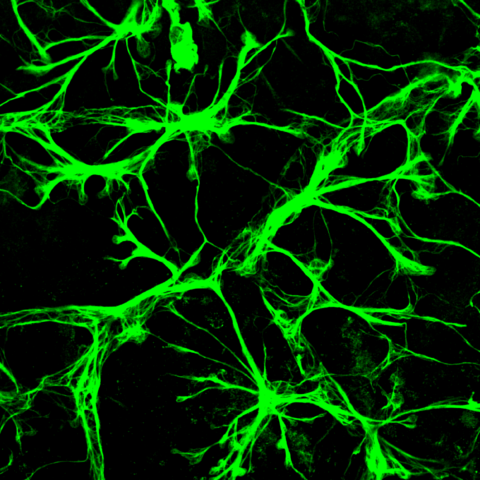 Astrocytes in the mouse retina form a delicate, ramified web that weaves a complex cellular architecture.