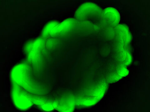 Human Pluripotent Stem Cell-Derived Cortical Organoids by Dosh Whye