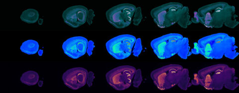 Lightsheet Illuminating Our Knowledge of the Brain by Andrew Silberfeld