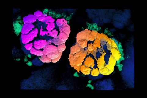 Projection Neurons of the Fruit Fly Antennal Lobe by Matthew Churgin