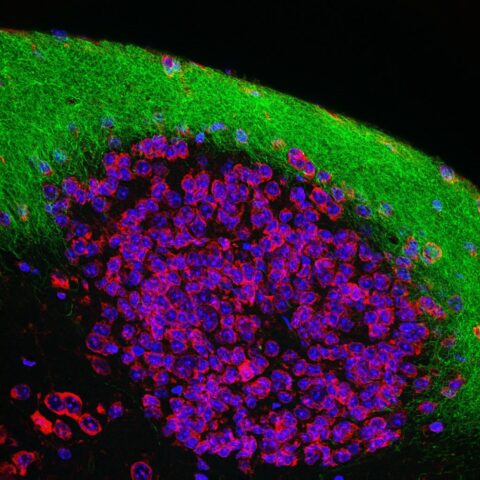 Lateral Olfactory Tract by David Brann