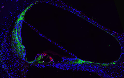 Distribution of GJB2 in a Nonhuman Primate Cochlea by Maryna Ivanchenko