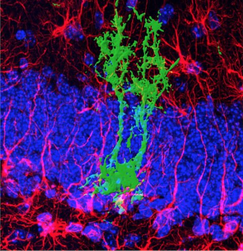 Symmetric Division of a Neural Stem Cell by Haley Zanga