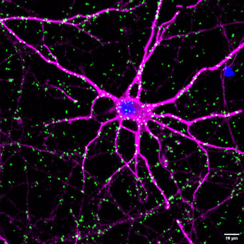Proximity of BMAL1 and CaMKIIα at Synapses in a Primary Neuron by Ilaria Barone