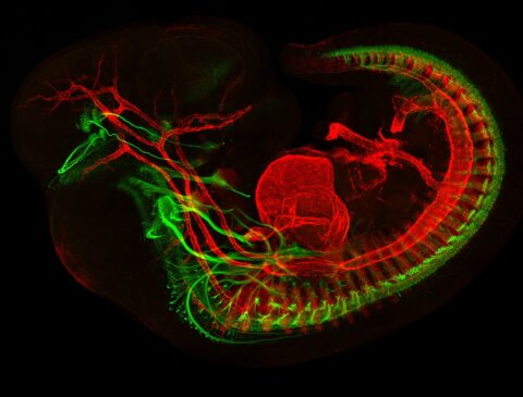 Developing Motor Neurons and Muscles in E11.5 Mouse by Jess Bell & Mary Whitman