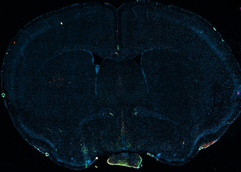 Cluster of E1 Neuronal Population in a Virgin Male Mouse by Samantha Finkbeiner