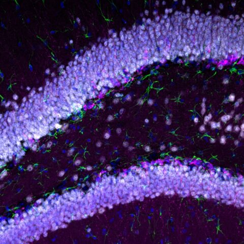 Birth of New Neurons in the Adult Mouse Brain by Brittany Mayweather