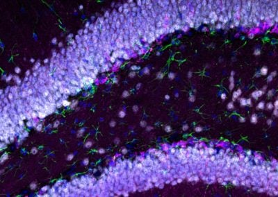 Birth of new neurons in the adult mouse brain