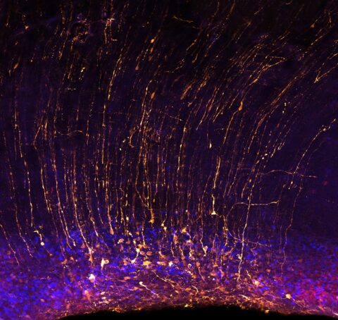 Cortical Sparks by Lariza Rento