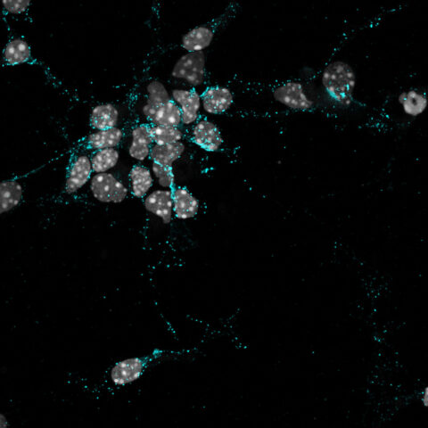 Neuronal Clusters by Evelyn Aviles