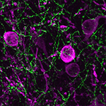 orepinephrine-producing axons (stained green) and dopamine-producing cells (stained magenta) can be intermixed in the brain. Image: Ricardo López