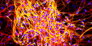 850-MAP2-tau_in_neurons