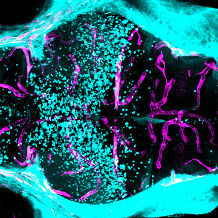 When researchers injected fluorescent dye (blue) into the circulatory system of a zebrafish with a spock1 mutation, the dye leaked out of blood vessels (pink) in the forebrain and midbrain (left), but stayed relatively confined within the hindbrain (right), revealing a blood-brain barrier that was permeable in some areas but not others. Image: Natasha O’Brown