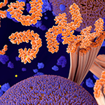 Alzheimer disease: Tau proteins aggregate to neurofibrillary tangles