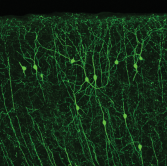 GFP in cortical neurons expressing ChAT, an enzyme necessary for making the neurotransmitter acetylcholine.