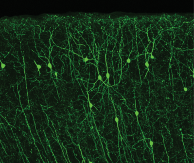 GFP in cortical neurons expressing ChAT, an enzyme necessary for making the neurotransmitter acetylcholine.