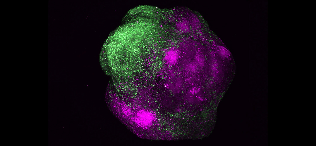 Human brain organoid showing the integration of excitatory (magenta) and inhibitory neurons (green) of the cerebral cortex