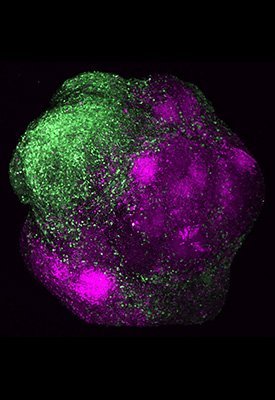 Human brain organoid showing the integration of excitatory (magenta) and inhibitory neurons (green) of the cerebral cortex