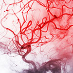 Cerebral angiography image from Fluoroscopy in intervention radiology showing cerebral artery.