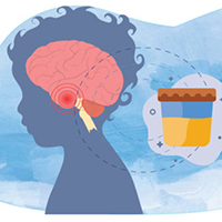 Brain tumor bch