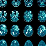 a collage of brainscans
