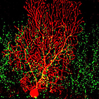 image of Purkinje cell
