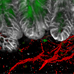 HMS researchers have identified the molecular conversation that occurs between pain neurons (red) in the gut and intestinal goblet cells (green) as a mechanism involved in protective pain signaling that shields the gut from damage. Image: Chiu Lab/HMS