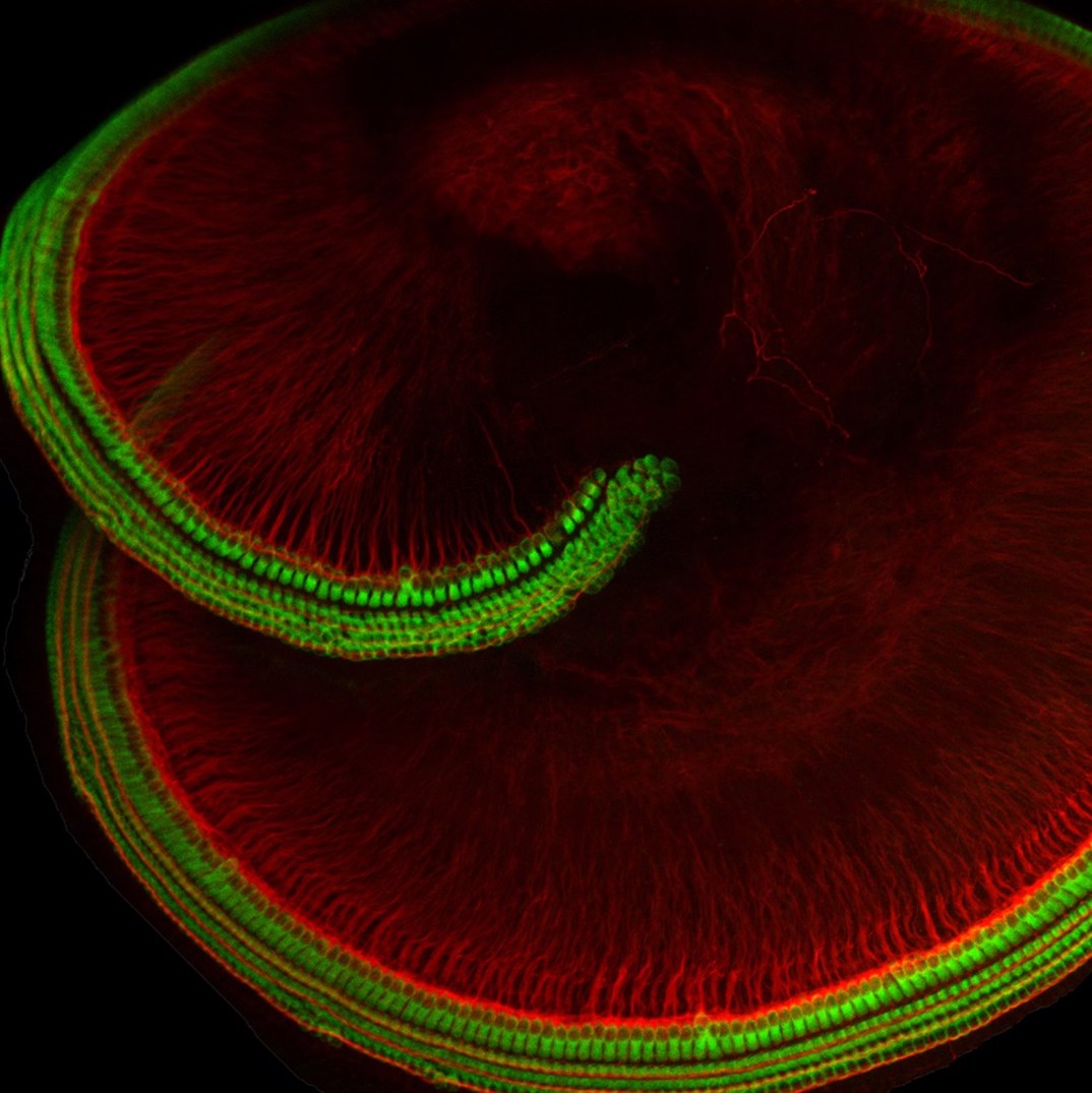 image of a cochlea
