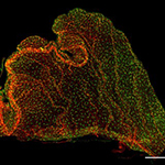 An adult choroid plexus explant from the Cx3cr1-GFP transgenic mouse, stained wtih PECAM to label the vasculature
