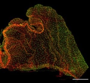 An adult choroid plexus explant from the Cx3cr1-GFP transgenic mouse, stained wtih PECAM to label the vasculature.