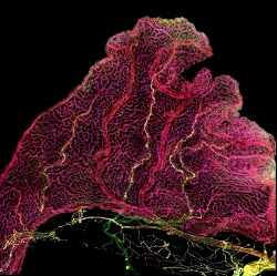 Immunofluorescence imaging of choroid plexus