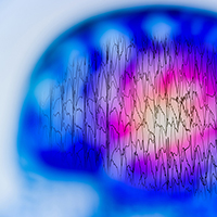 EEG with electrical activity of abnormal brain, electroencephalogram,EEG