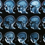 MRI scan of the human brain