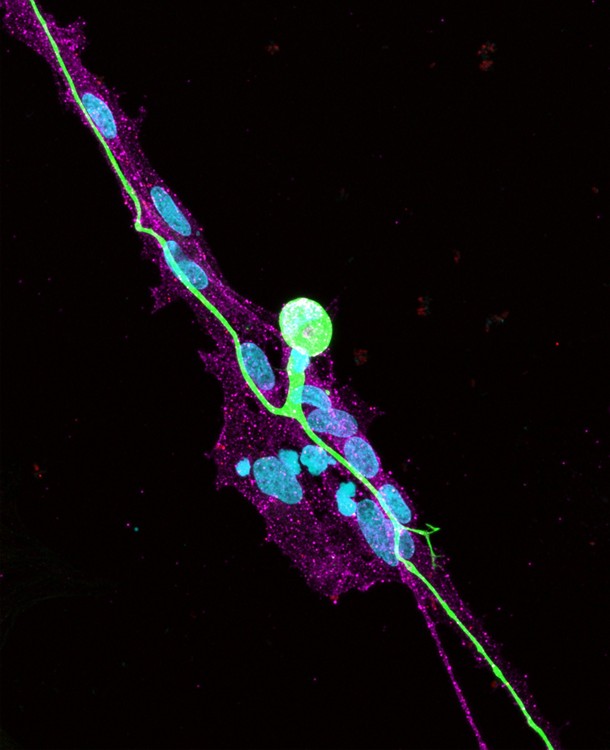 iPSC-derived sensory neurons provide an accessible platform for scientists to study sensory biology and disease; however, these cells are similar to embryonic neurons. Chelsey Derderian-LeBlang and Rosalind Segal present a protocol to accelerate the maturation of iPSC-derived sensory neurons, by providing external signals from satellite glial cells. They show that satellite glia, while previously described as a support cell, play a major role in both sensory neuron development and degeneration. 