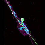 Human iPSC-derived sensory neurons (green) matured in contact with rodent satellite glia (magenta) develop mature, T-shaped, pseudounipolar morphology. All cell nuclei are shown in blue.