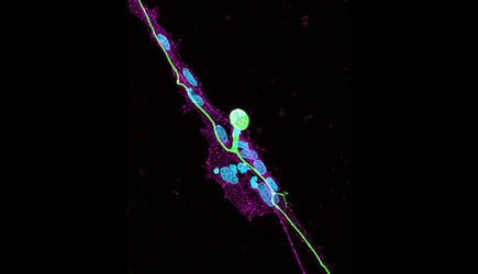 iPSC-derived sensory neurons provide an accessible platform for scientists to study sensory biology and disease; however, these cells are similar to embryonic neurons. Chelsey Derderian-LeBlang and Rosalind Segal present a protocol to accelerate the maturation of iPSC-derived sensory neurons, by providing external signals from satellite glial cells. They show that satellite glia, while previously described as a support cell, play a major role in both sensory neuron development and degeneration.