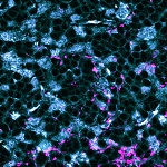 cerebellar granule cells with GABAergic synapses