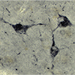 SKA2 immunostaining in neurons of the human brain.