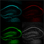 Immunofluorescence imaging of three key stress proteins in the mouse hippocampus