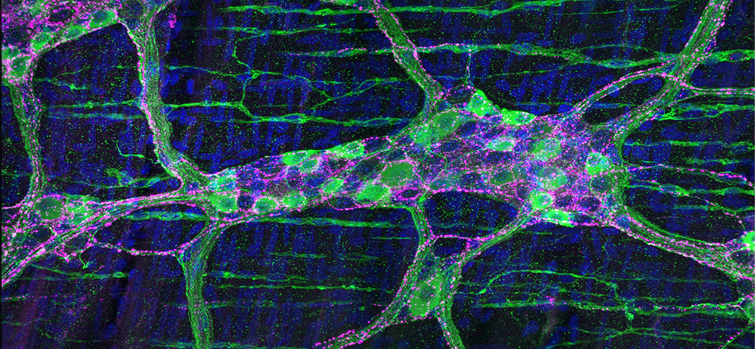 Enteric neurons reside within the gut, so numerous that they have been referred to as "the body's second brain". Within the muscle walls of the colon, clusters of enteric neurons form a neural net (myenteric plexus) that contributes to various GI functions, including gut motility, sensing, and secretion. Enteric neurons signaling through nitric oxide (nNOS) are labeled in green. In magenta are sensory nerve fibers that release the neuropeptide CGRP. Cell nuclei are labeled in blue.
