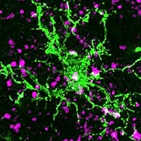 A microglia cell (shown in green) and corticostriatal synapses (purple) from a patient with Huntington’s disease.