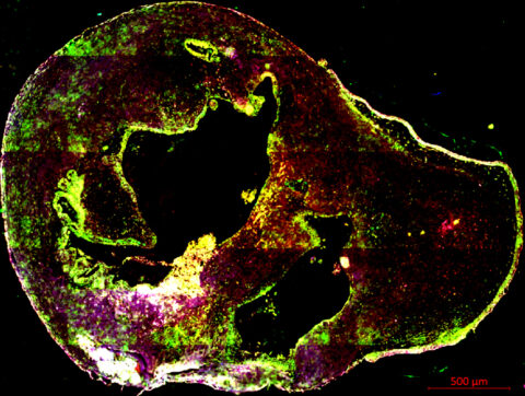 Man-Made Brain by Annie Kathuria